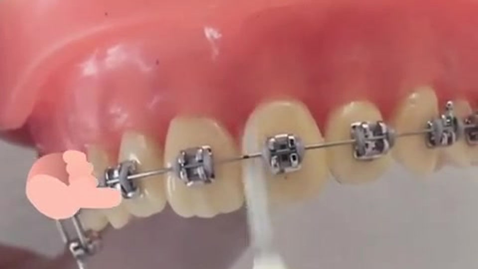 Cepillo interproximal